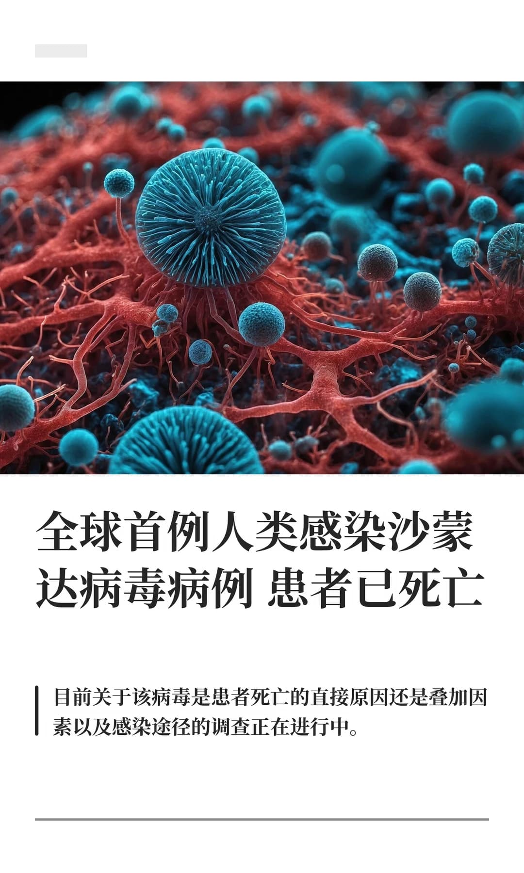 法国确诊全球首例人类沙蒙达病毒感染病例，患者已死亡 - 图片1